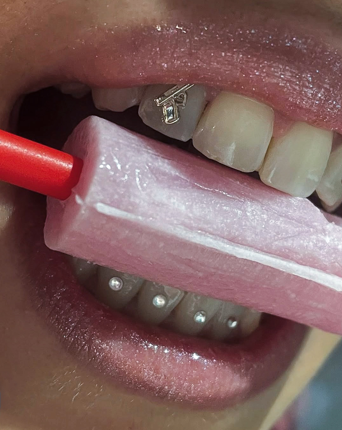 Tooth 2 Sara