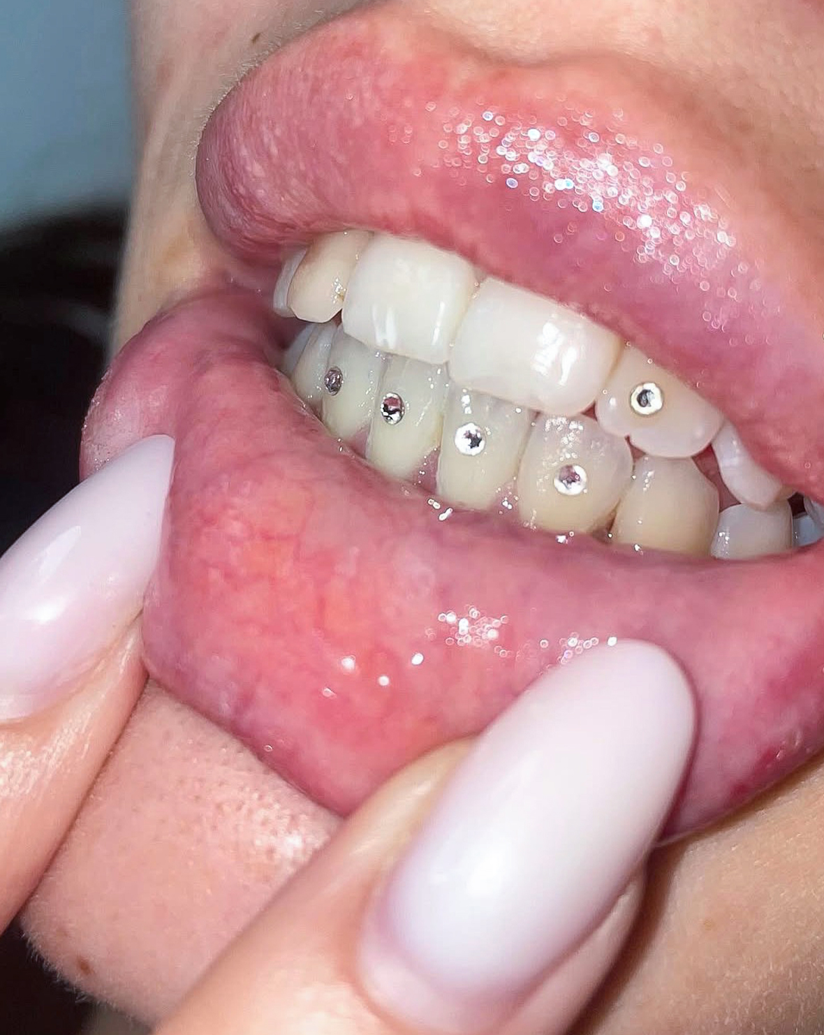 Tooth 3 Sara